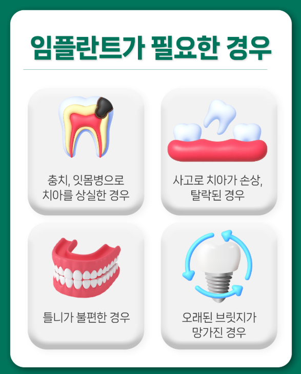 부천시 심곡동 임플란트 비용 및 치료기간, 보험적용 기준 안내